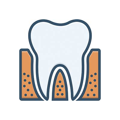 Root Canal in Noblesville, IN